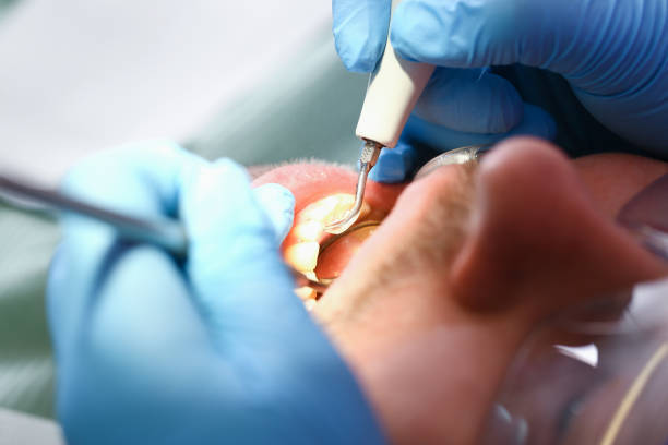 Emergency Dental Services for Seniors